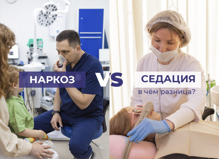 наркоз и седация в чем разница